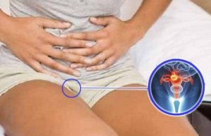 7 varoitusmerkkiä kohdunkaulan syövästä