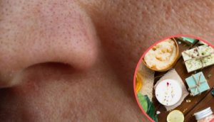 8 kotihoitoa ihohuokosten supistamiseksi