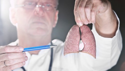 mitä tehdä kemoterapian sivuoireiden lievittämiseksi