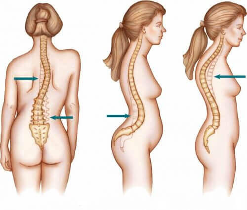 Some figure