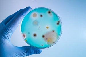Varo näitä yhdeksää ihmiselle vaarallista bakteeria