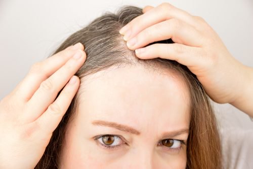 Käytä näitä 6 yrttiä ja maustetta edistämään hiusten kasvua