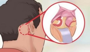 Kolmoishermosärky - 5 faktaa maailman kivuliaimmasta sairaudesta