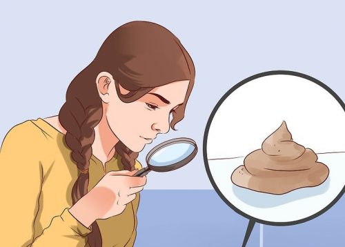 Mitä ulosteen väri ja koostumus kertovat terveydestä