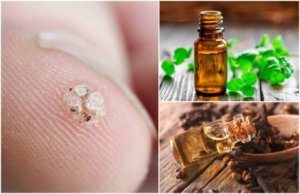 7 eteeristä öljyä syylien karkottamiseksi