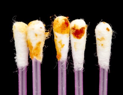 Korvavaikun tehtävä on suojata korvaa.