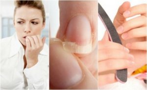 8 syytä kynsien haurauteen