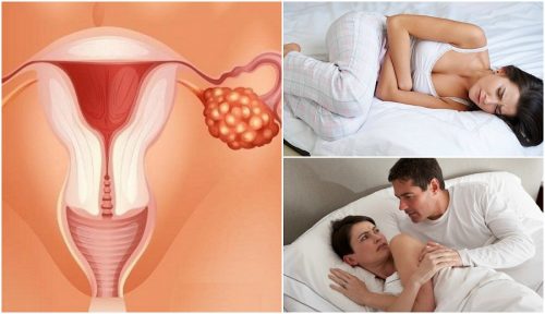 7 munasarjasyövän oiretta, jotka jokaisen naisen tulisi tietää 7 munasarjasyövän oiretta, jotka jokaisen naisen tulisi tietää