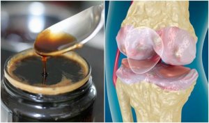 Vahvista niveliä ja luita helpolla kotihoidolla