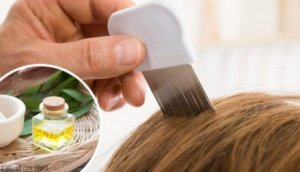 6 kotihoitoa täiden karkottamiseksi