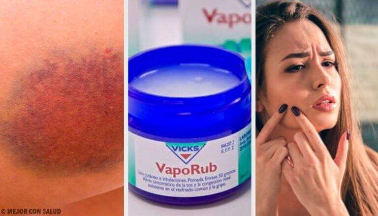 11 yllättävää tapaa käyttää Vicks VapoRubia