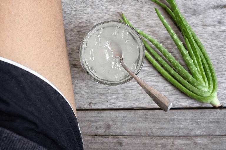 hoidot suonikohjuihin: aloe vera