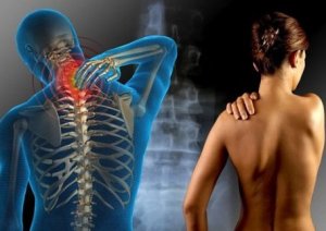 Mitä fibromyalgiasta tarvitsee tietää?