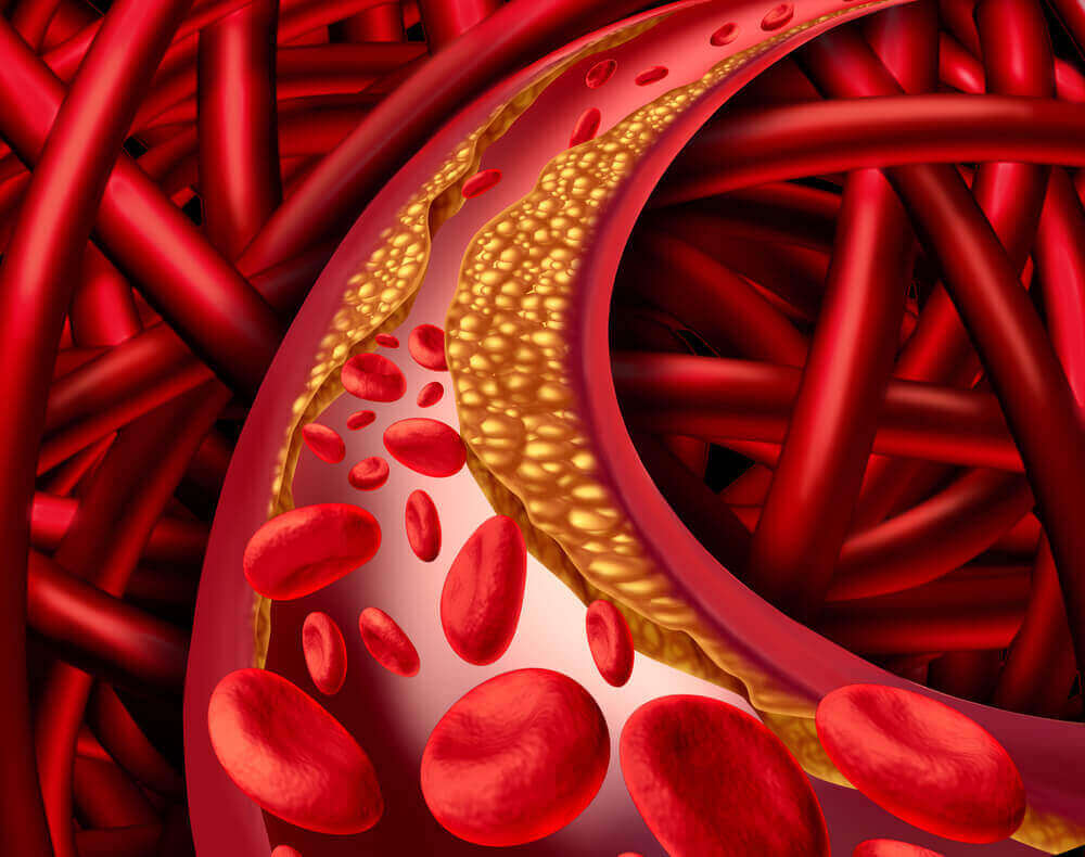 verisuonet
