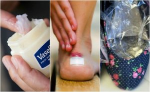 7 keinoa estää kenkien aiheuttamia rakkoja