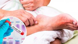 5 tavallista syytä veren korkeaan virtsahappopitoisuuteen