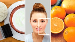 Mahtavia luontaishoitoja näppylöihin