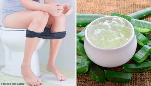 Näin hoidat peräpukamat kotikonstein