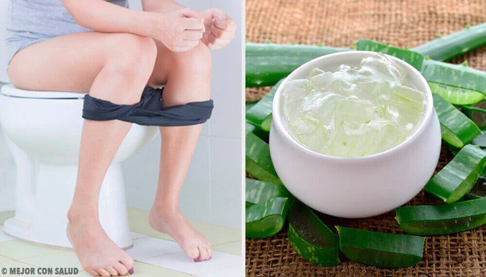 Näin hoidat peräpukamat kotikonstein