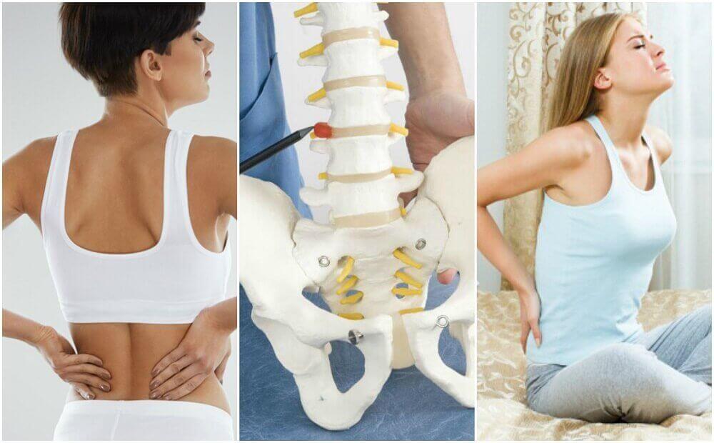 8 fyysistä ongelmaa, jotka aiheuttavat selkäkipua