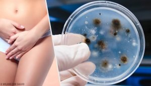 Emätintulehdukset: tulehdustyypit ja aiheuttajat