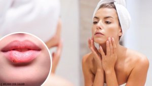 Nämä 13 merkkiä kasvoilla voivat kertoa terveysongelmista