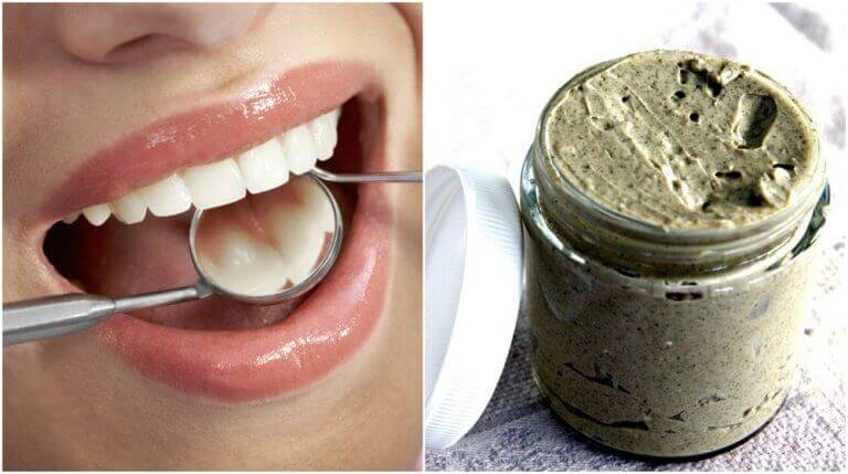 Luonnollisia keinoja ehkäistä hampaiden reikiintyminen