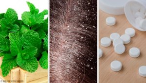 Eroon hilseestä kotihoidoilla