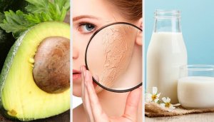 10 tapaa kosteuttaa ihoa kotitekoisilla luonnollisilla hoidoilla