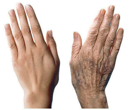 7 suositusta ikääntyvien käsien hoitamiseksi