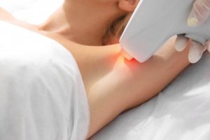 Ihokarvojen poisto laserilla: myytit ja faktat