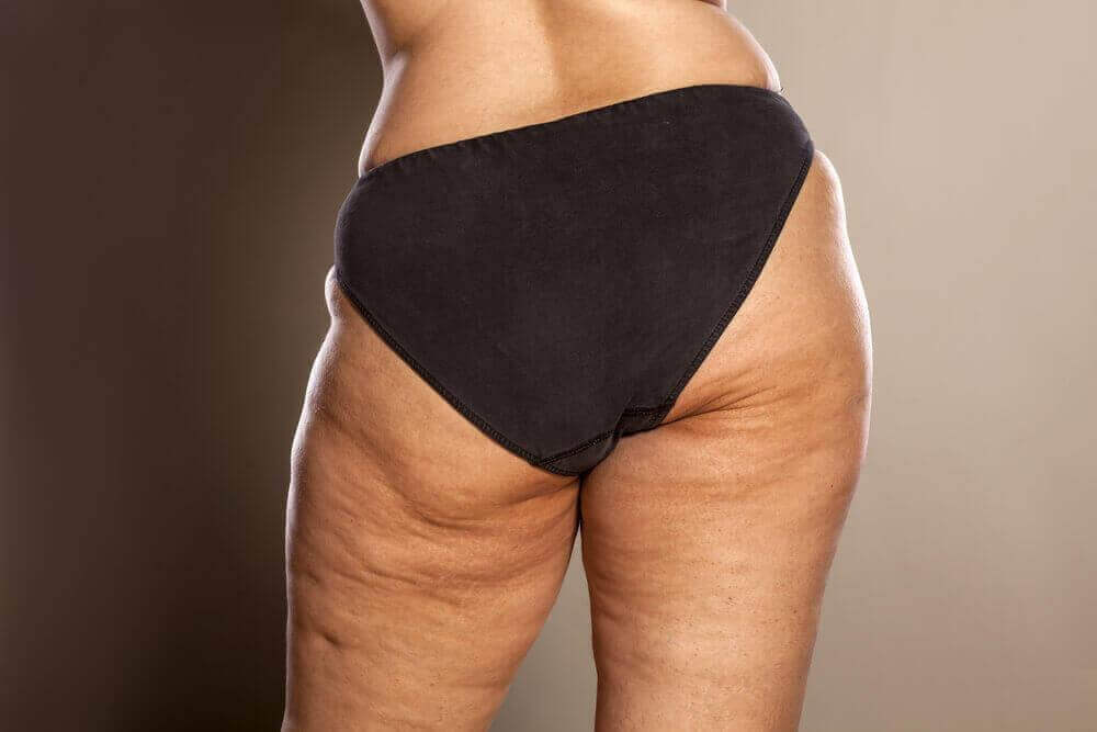 Some figure