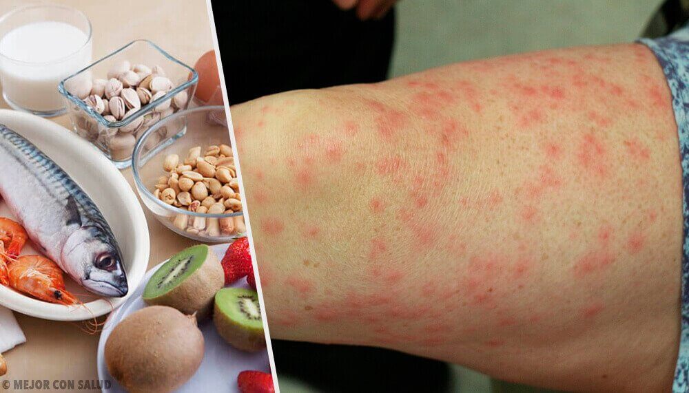 Yleisimmät ruoka-aineallergiat ja hyviä korvikkeita allergisoiville ruuille Yleisimmät ruoka-aineallergiat ja hyviä korvikkeita allergisoiville ruuille