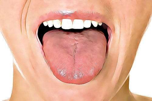 6 kotihoitokeinoa suun haavaumiin