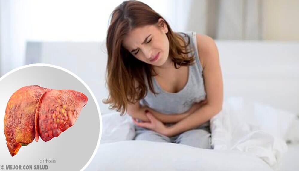 naisella maksakirroosi
