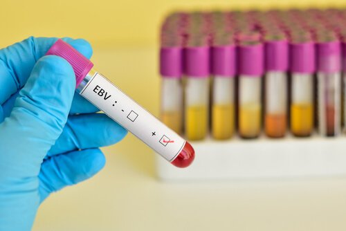 mononukleoosi -testi