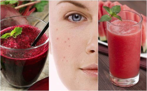Taistele aknea vastaan puhdistavien smoothieiden avulla