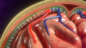 Millainen sairaus on aivokalvontulehdus?