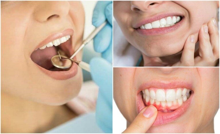 7 hammastulehdukseen viittaavaa oiretta