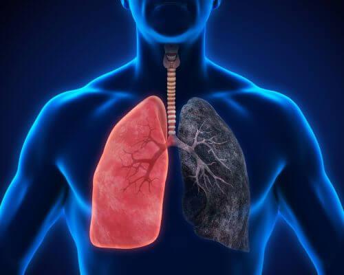 8 keuhkokuumeen oiretta