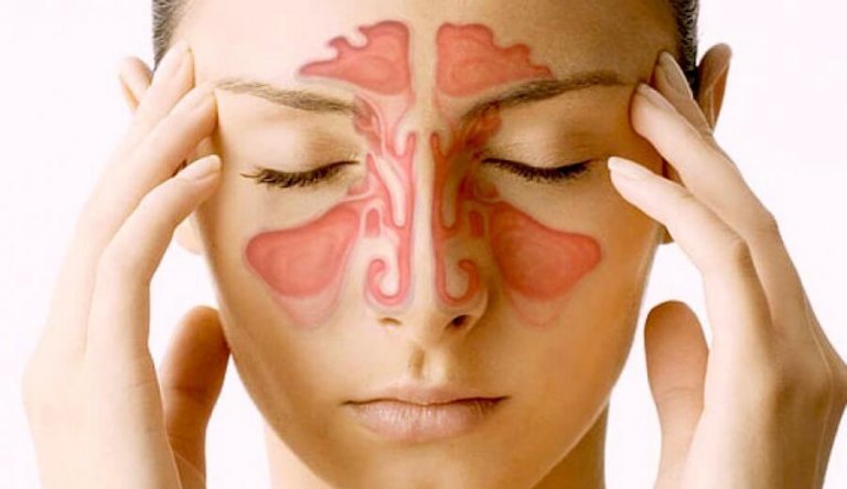 Nenän sivuontelot: 5 mielenkiintoista faktaa