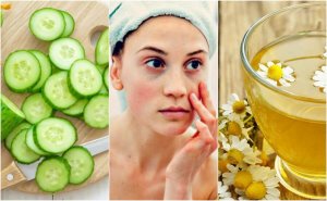 Häivytä tummia silmänalusia 5 luontaishoidolla