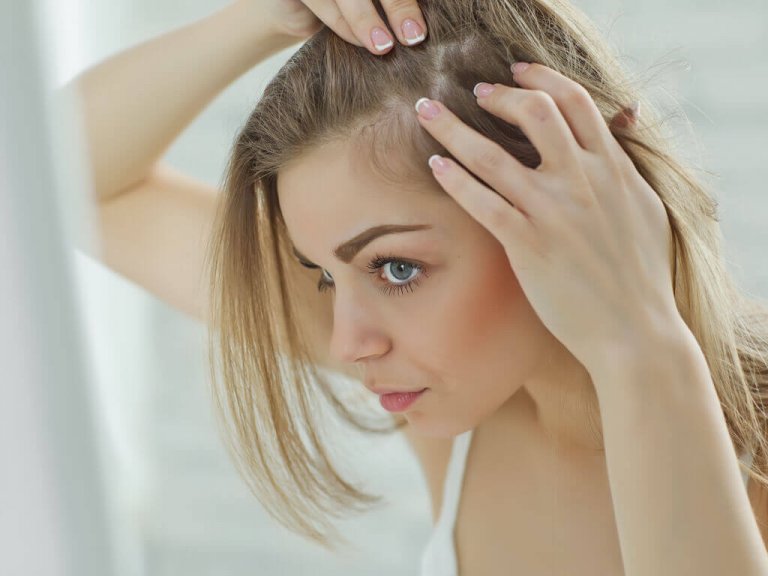 10 yleistä syytä hiustenlähtöön