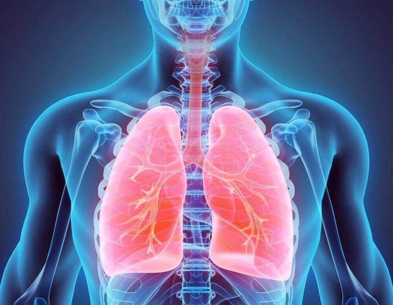 Luontaishoidot keuhkoputken laajentumatautiin (bronkiektasia)