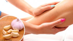 Parhaat luontaishoidot nesteen kertymiseen