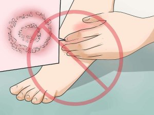 Ruusun hoito kotikeinoin