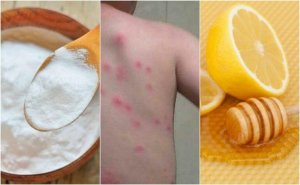 5 kotihoitoa kirpun puremiin