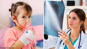 Keuhkokuumeen hoito: kaikki mitä sinun tulee siitä tietää