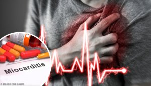 Myokardiitti: syyt, oireet ja hoito