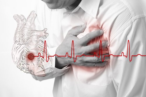 Sydäninfarkti: riskitekijät, oireet ja hoito